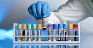 Hematologia