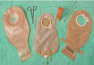 Ostomies