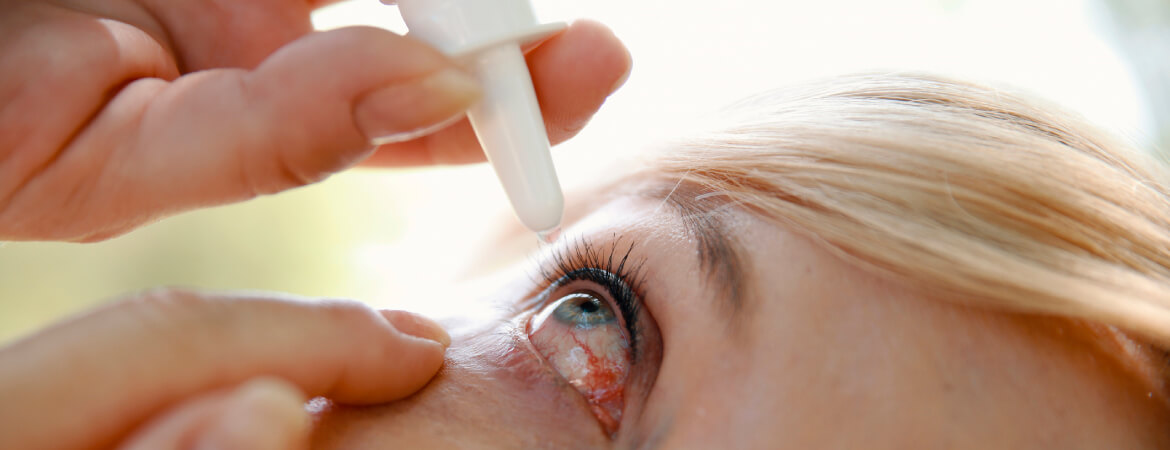 Conjuntivitis-husc