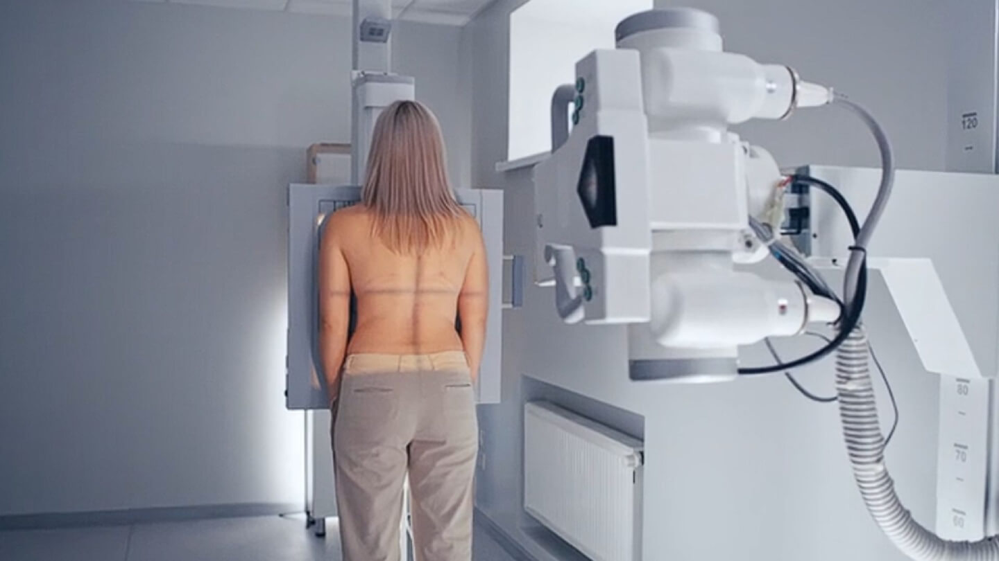 medicina-personalizada-cancer-mama