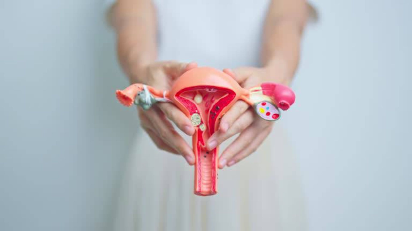 miomas-uterinos-sintomas-diagnostico-tratamientos