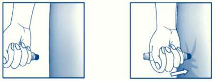 Alergia a la picadura de abeja CV y HUGC